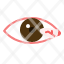 pterygium-eye-conjuctiva-membrane-cornea-pinguecula-icon